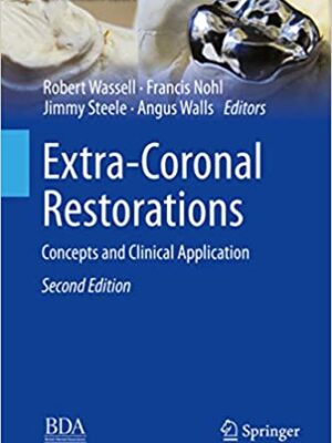 دانلود کتاب Extra-Coronal Restorations 2nd Edition