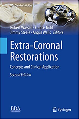 دانلود کتاب Extra-Coronal Restorations 2nd Edition دانلود کتاب Extra-Coronal Restorations 2nd Edition