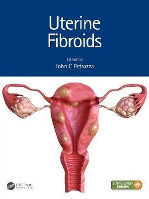 دانلود کتاب Uterine Fibroids