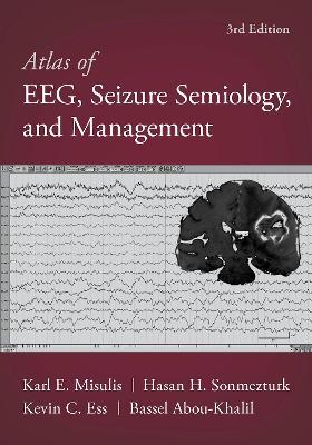 دانلود کتاب Atlas of EEG, Seizure Semiology, and Management 3rd Edition