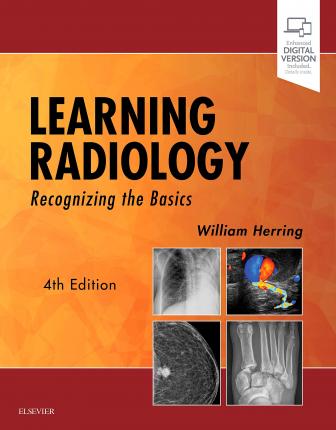دانلود کتاب Learning Radiology: Recognizing the Basics 4th Edition دانلود کتاب Learning Radiology: Recognizing the Basics 4th Edition