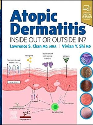 دانلود کتاب Atopic Dermatitis