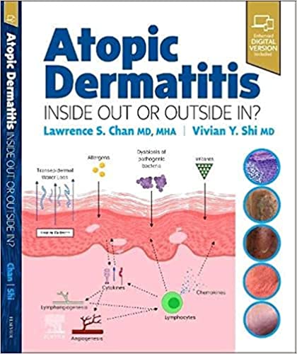 دانلود کتاب Atopic Dermatitis دانلود کتاب Atopic Dermatitis